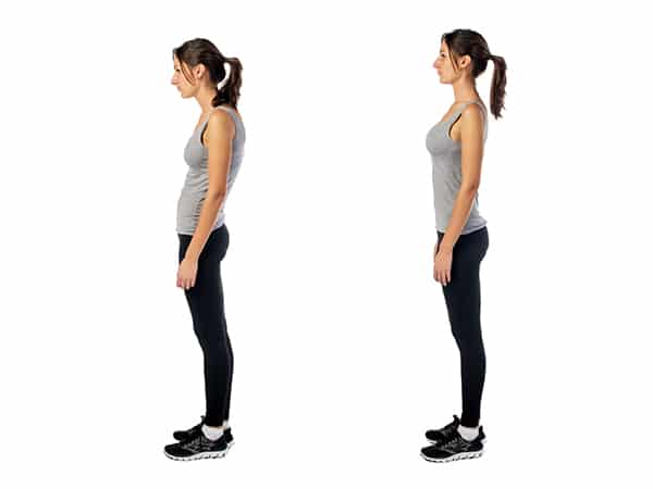 Scoliosis Treatment Kaysville UT