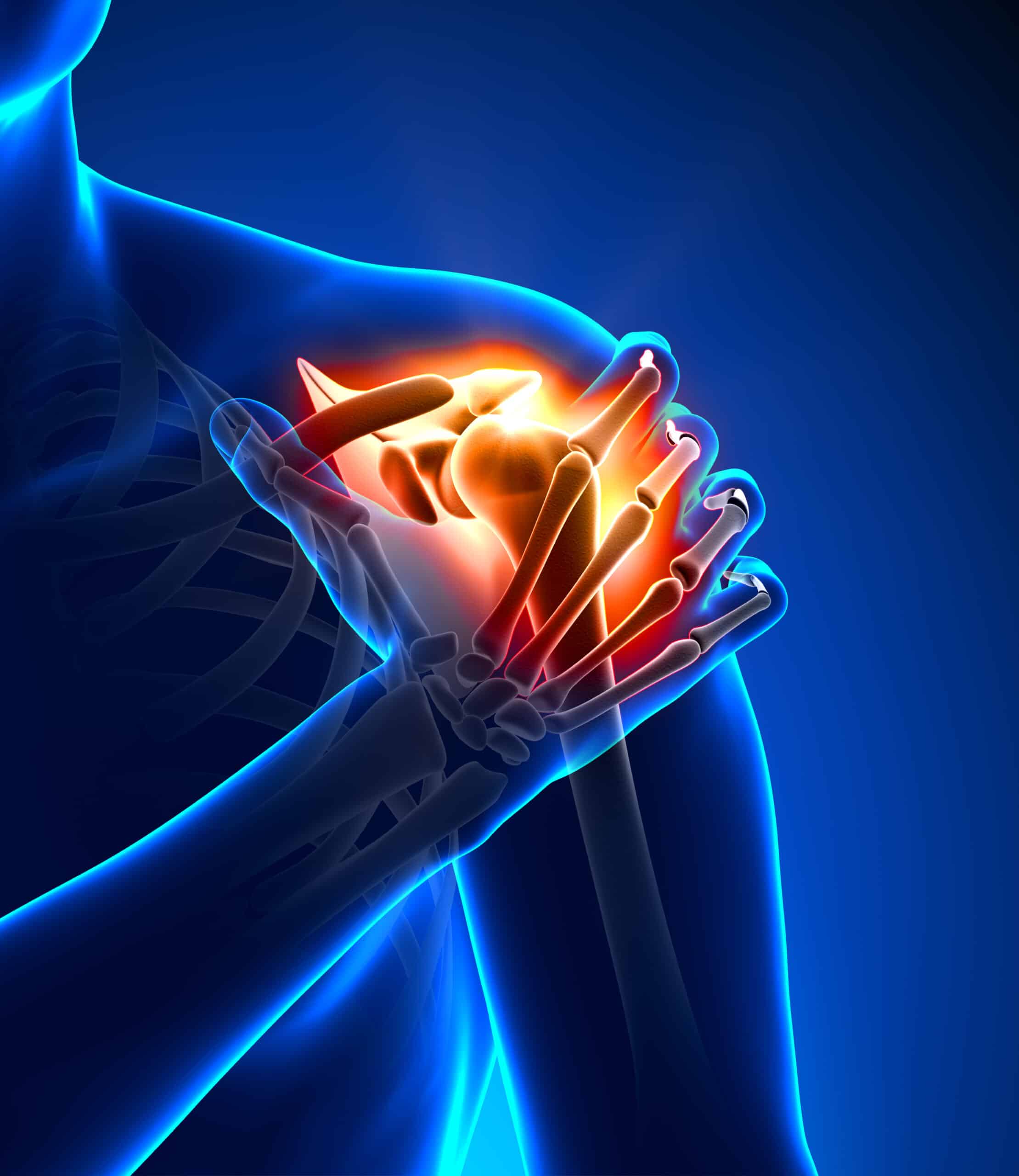 Shoulder injuries Kaysville UT